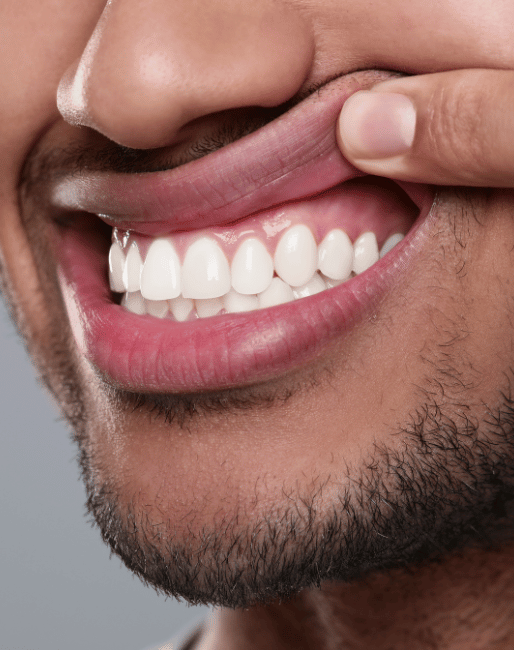 Treatment Category - Fen House Dental Practice
