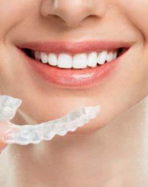Invisalign